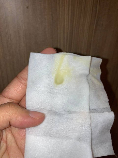 37 weeks pregnant. Normal lang po ba itong discharge ko? Wala pa naman po akong kakaiba nararamdaman