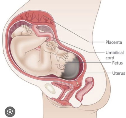 COMPOUND FETAL PRESENTATION