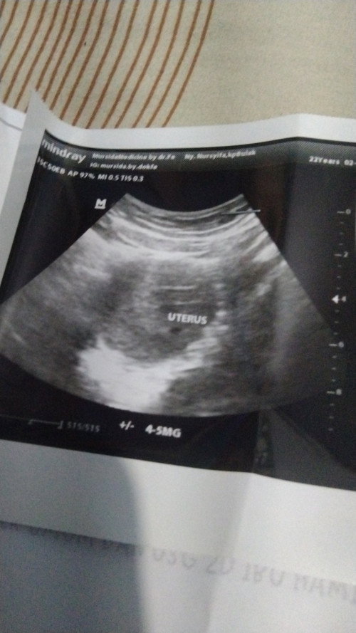 Bunda sharing yuuk