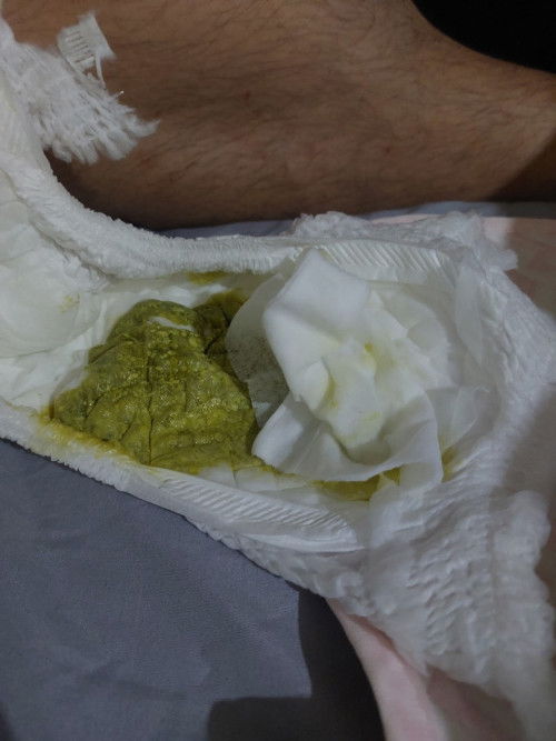 วัคซีน4เดือน