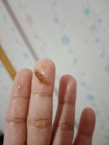 มีมูกสีน้ำตาล ต้องไปหาหมอเลยมั้ยคะ