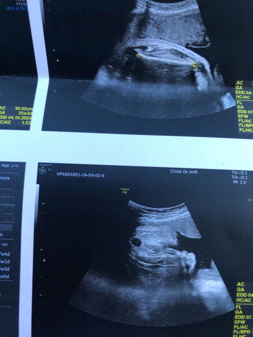 แม่ๆคะชายหรือหญิงคะ