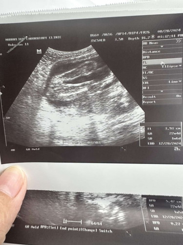 Girl or boy?