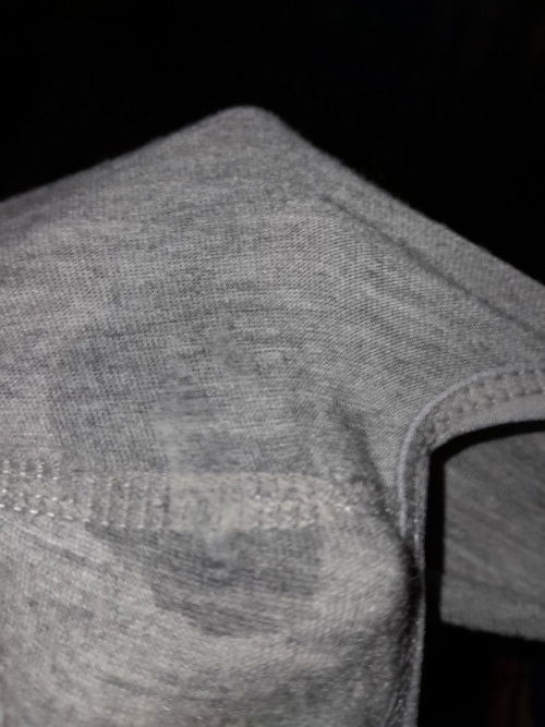 Ketuban rembes arau keputihan ya