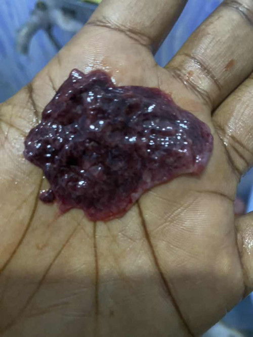 AM I STILL PREGNANT?