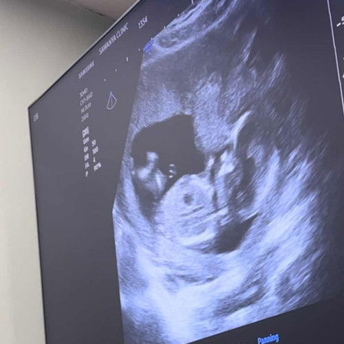 เพศอะไรเอ่ย?