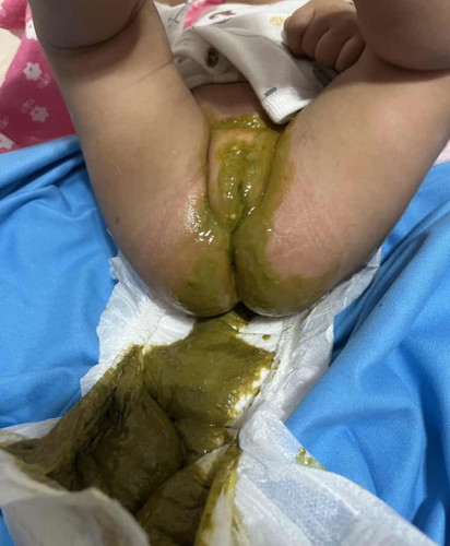 Normal po bang poop to?