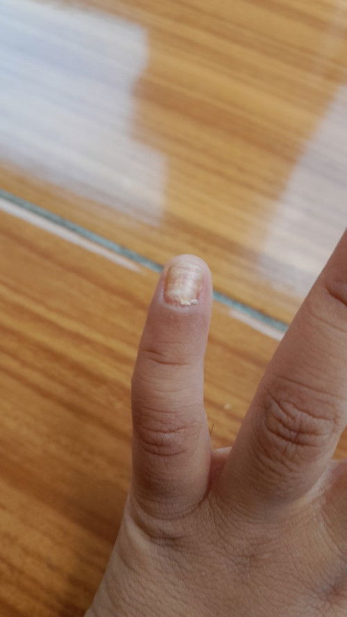 Kuku jari kelingking berbeda dari yang lain