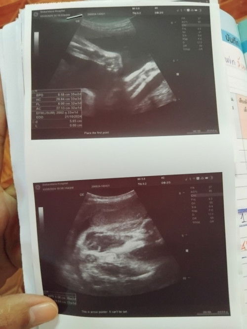 ดูเพศให้หน่อยค่ะแม่