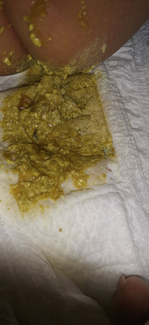 Normal lang po kaya ganitong tae ni baby