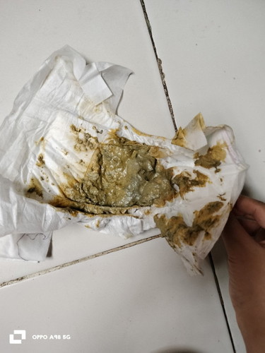 Di sini ada yg minum sufor bebelove ga ..anak usia 2 bulan
Sufor itu Pupnya ijo bund