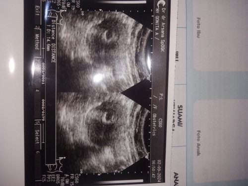 kasih semangat yuk bun