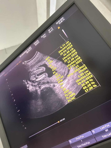 ช่วยดูหน่อยค่ะแม่ ซาวด์มา 18+1week หมอบอกมีเกณฑ์ได้ลูกสาว60% ยังเรียบๆไม่มีจู๋โผล่ ดูจากในรูปแม่แม่ว่าได้ลูกสาวหรือลูกชายคะ