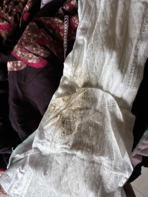 Keluar cairan kuning kental