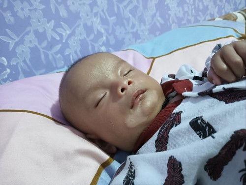 Tips menghilangkan putih di dagu