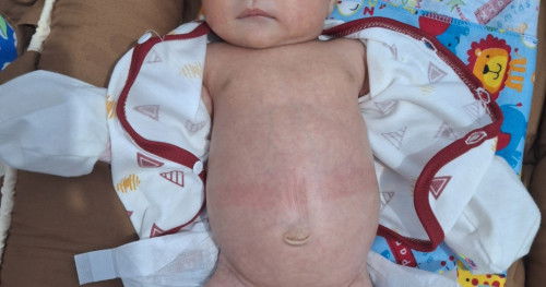 Perut bayi besar