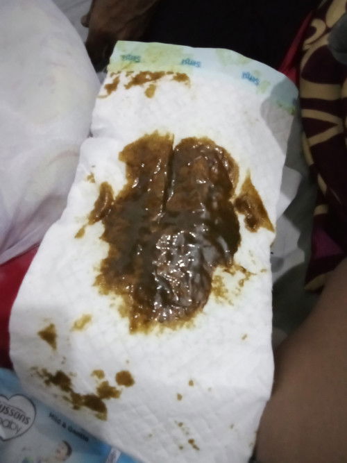 Warna BAB pada bayi New Born