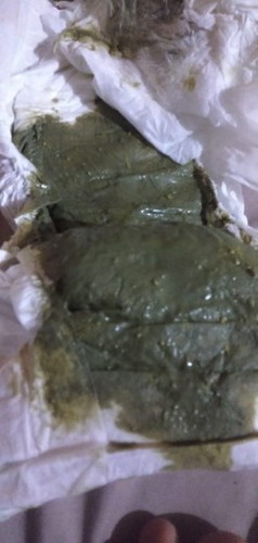 Bun, fases kayak gini apakah masih normal?