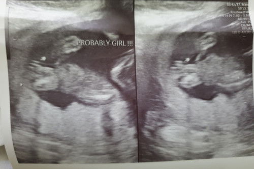 Sa tingin niyo po ba girl talaga to?