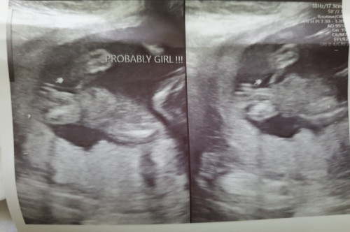 Sa tingin niyo po ba girl talaga to?