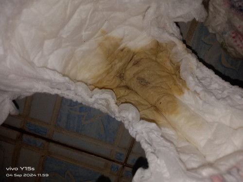 Bun maaf rada jiji soal bab anak