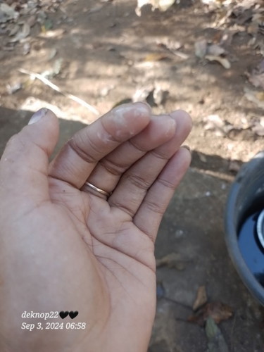 Bun saya hamil 7 minggu tp keluar keputihan seperti difoto apakah itu normal bun??