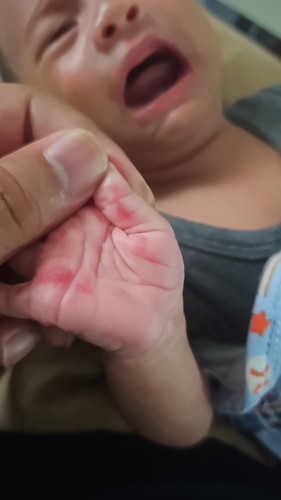 Tangan anak merah