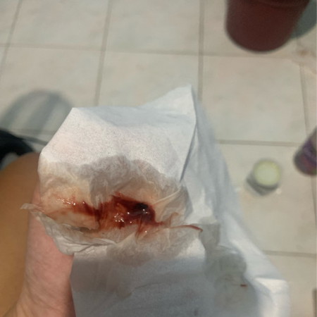 4mos preggy pero nag bleeding