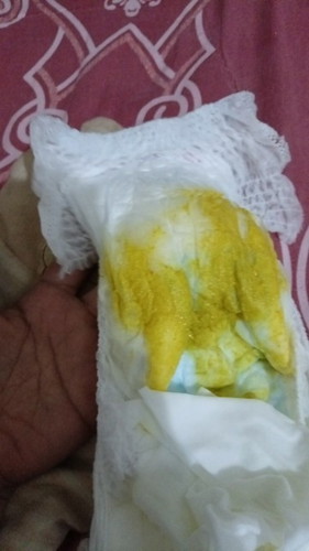 Ini ank prtma sya.. jdi sya krg tahu dan ingin brtnya,minta maaf soal gmbr ni..