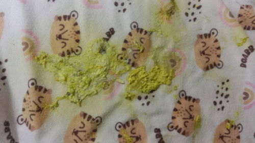 ลูกอึเป็นสีเหลืองเขียวแบบนี้ปกติไหมคะ