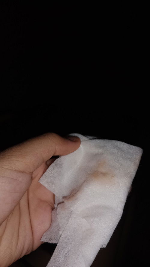 Flek coklat/merah muda