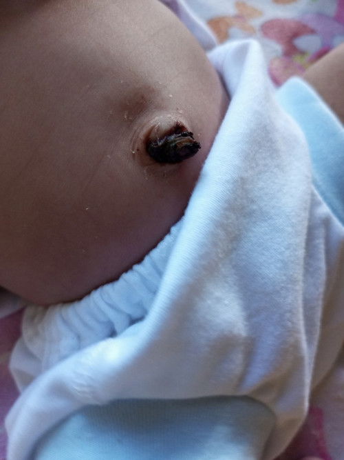 Tali pusat belum lepas