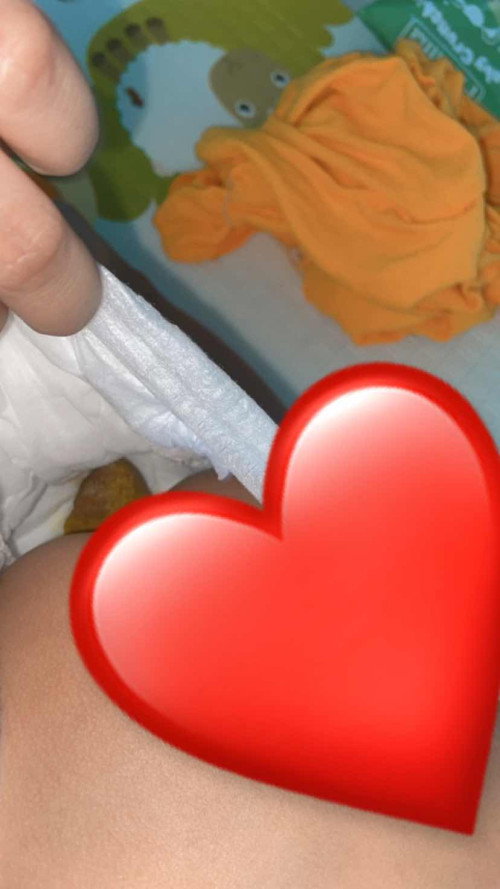 Maaf foto pup bayi 9 bulan bantu respon ya bun😭