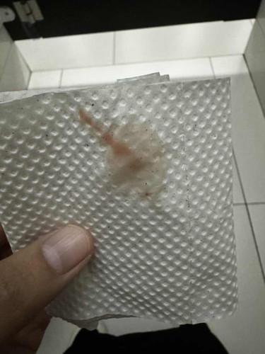Early bleeding