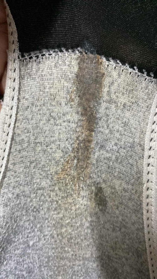 แบบนี้คือใกล้จะคลอดแล้วใช่มั้ยค่ะ