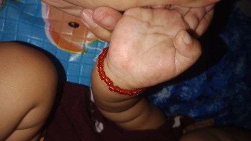 Bintik merah di telapak tangan dan kaki