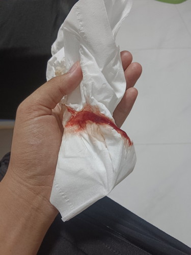 อาการหลังกระตุ้นรอบ2