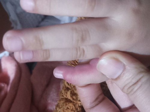 Kinamot lang nya kanina kasi makati daw bglang namaga, bumukol