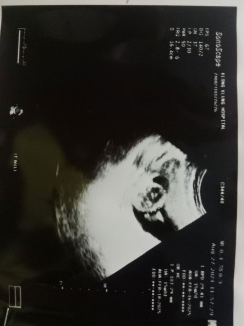 ลูกตัวเล็กมาก