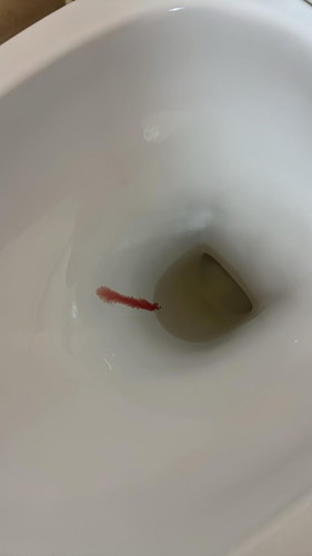 ท้องแรกมีเลือดออก