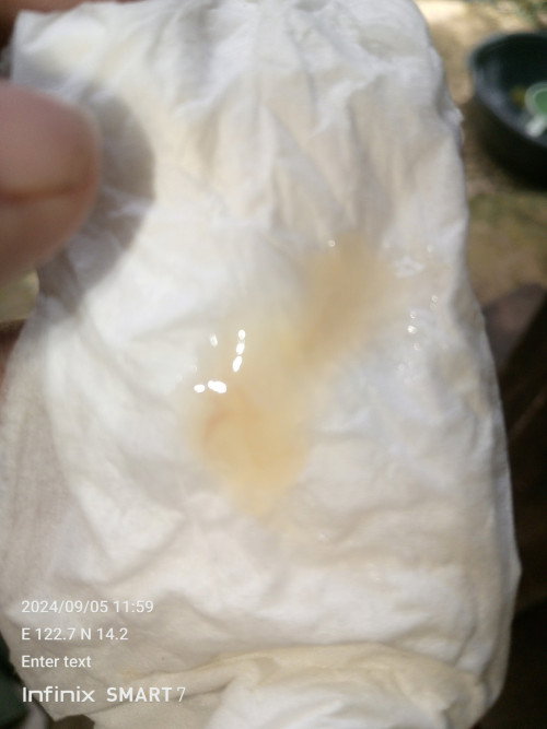 White discharge na may kaunting dugo sign of labor ba kahit no pain