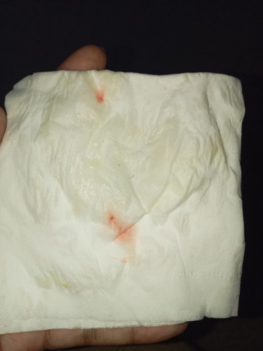 38+5วีคมีท้องแข็งบ่อย