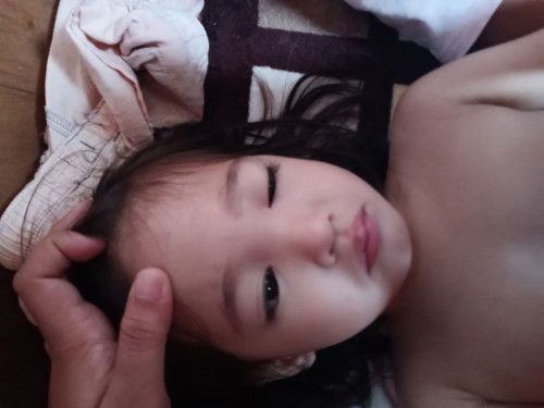 Tanong lang po ano po kaya insect ang kumagat sa anak ko sa may bandang nuo nya yung kagat namaga ,,