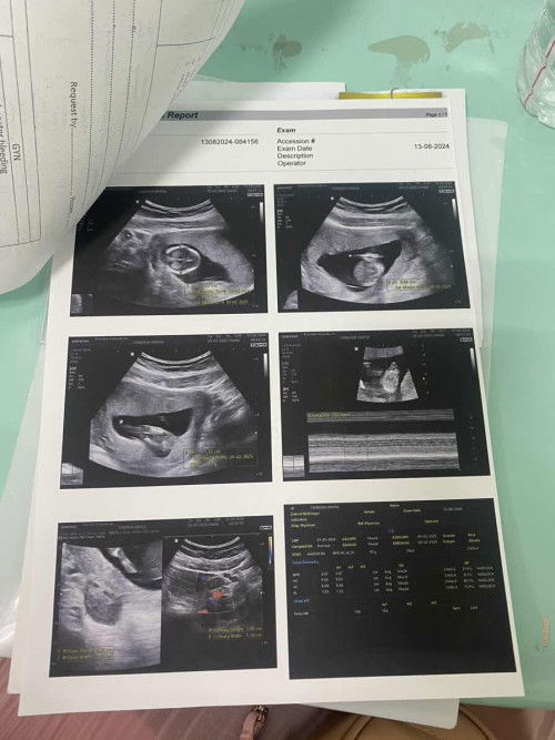 18w2dยังไม่ทราบเพศ