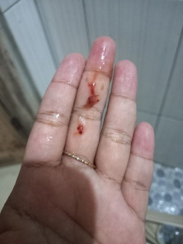 Flek darah