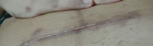 Bun, yg lahiran Mei pakai sc