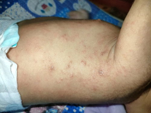 Bintik-bintik merah di badan