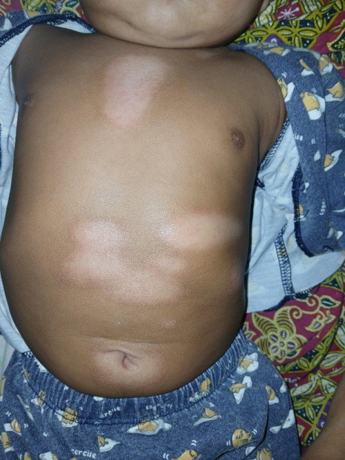 Kulit bayi putih putih