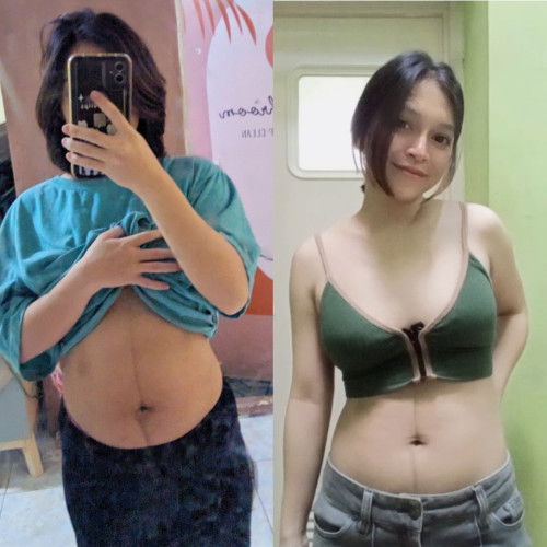 Tubuhku setelah melahirkan