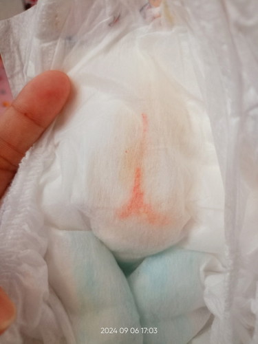 Kencing color pink bayi 2bln